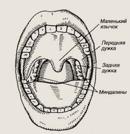 Гипертрофия небных миндалин у ребенка как лечить Гипертрофия небных миндалин у ребенка как лечить